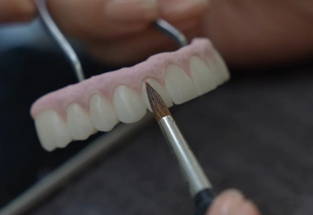Diş Laboratuvarı Üretim Süreci Reels Çalışması